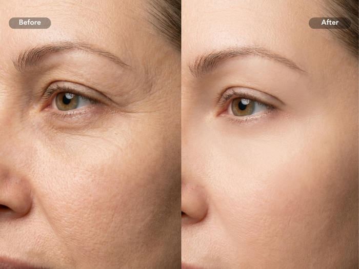 Customer before and after: Firmness