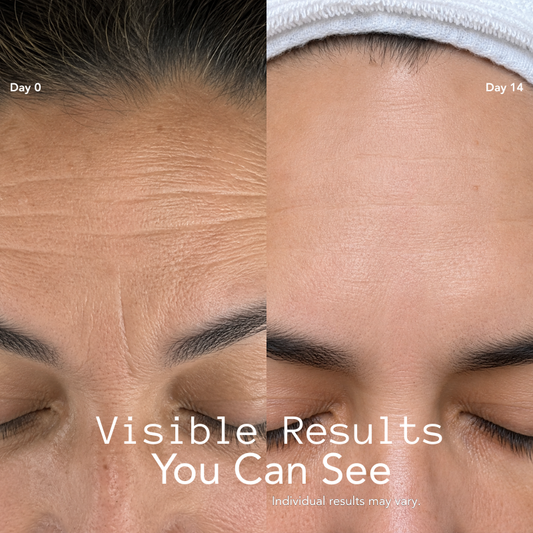 Clearer, Smoother Skin in 5 Minutes With Our Mask