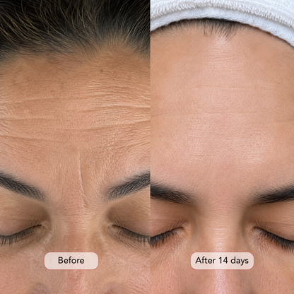 For Firmer, Smoother & More Radiant Skin