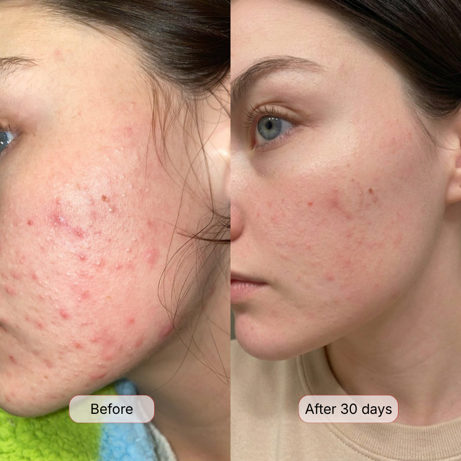Blemishes