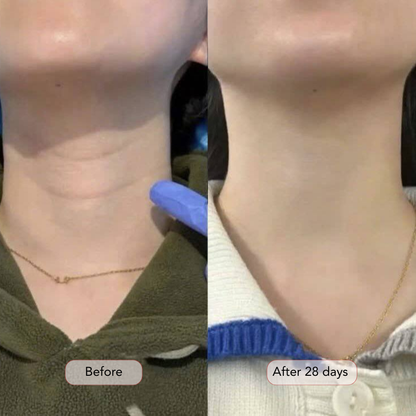 Professional Red Light Therapy Neck & Chest Mask