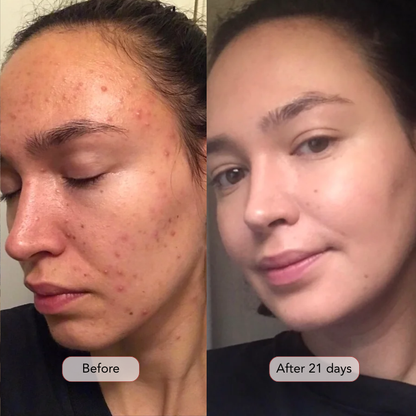 For Firmer, Smoother & More Radiant Skin