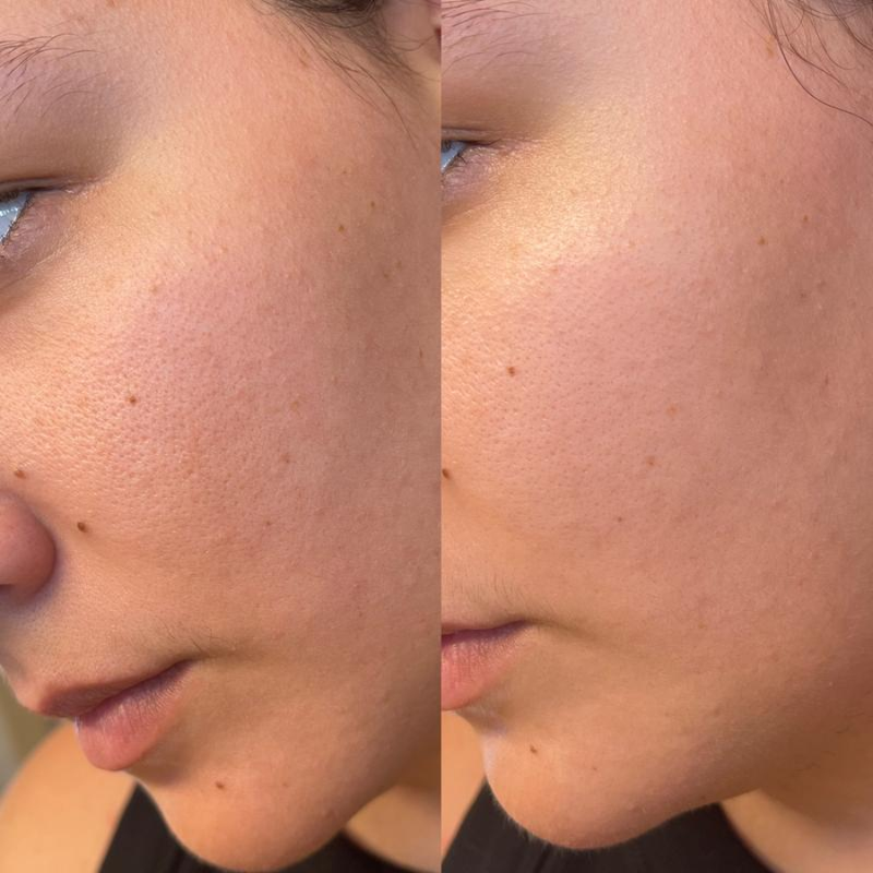 Glow & Pores