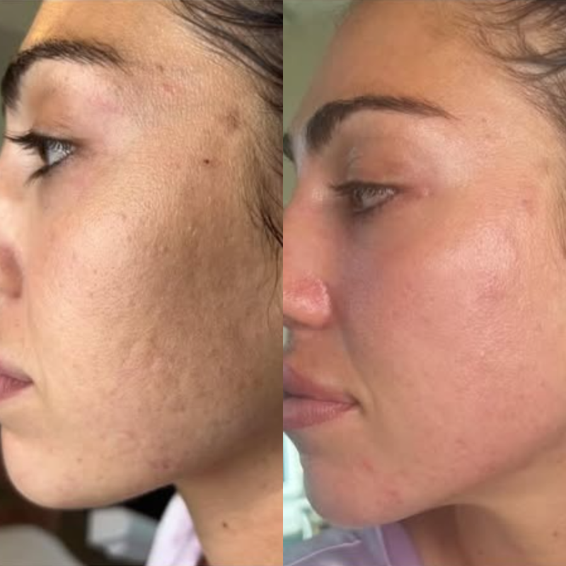 Dull & Uneven Texture