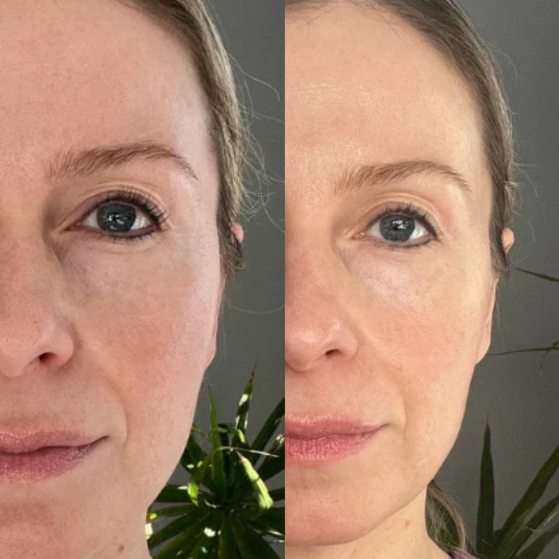 Redness & Inflammation