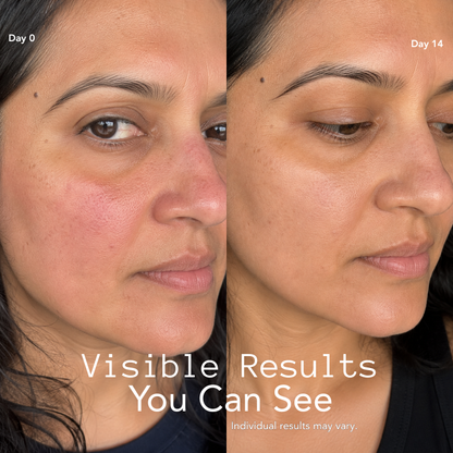 Clearer, Smoother Skin in 5 Minutes With Our Mask