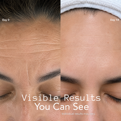 Clearer, Smoother Skin in 5 Minutes With Our Mask