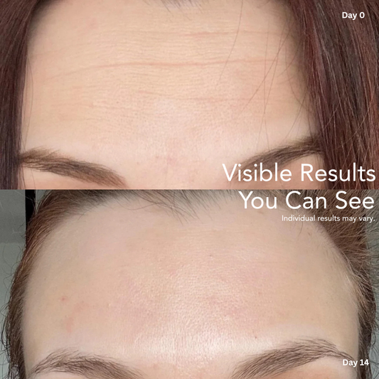 Corique Laser&LED Pro Mask