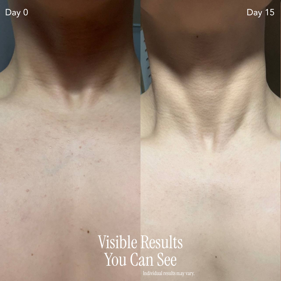 Firmer, Smoother Skin in 5 Minutes With Our Mask