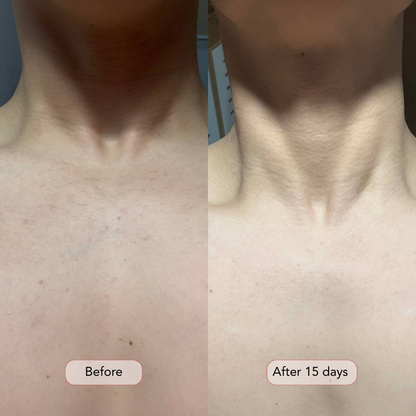 Professional Red Light Therapy Neck & Chest Mask
