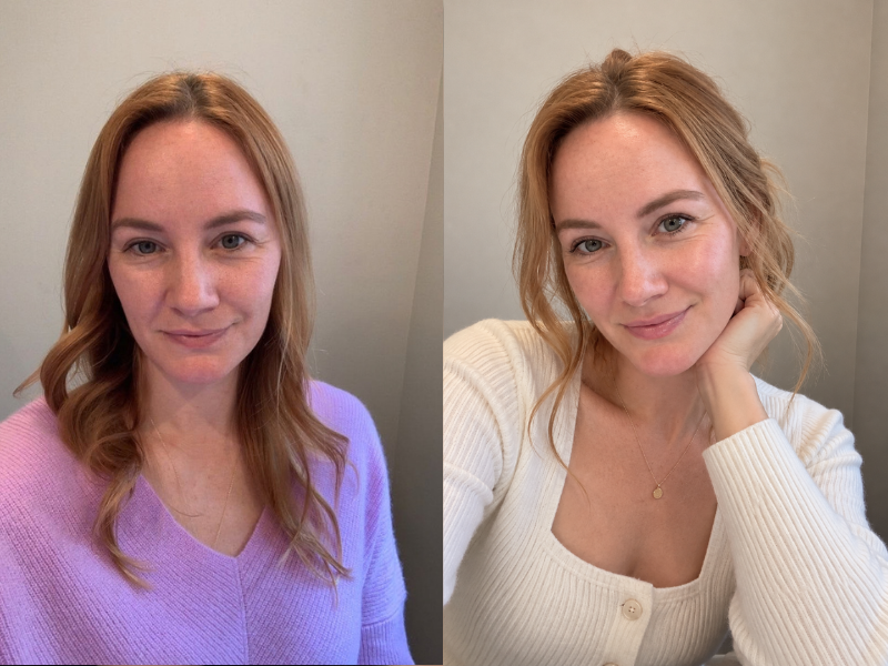 Overall Skin Radiance