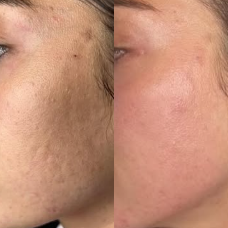 Dull & Uneven Texture
