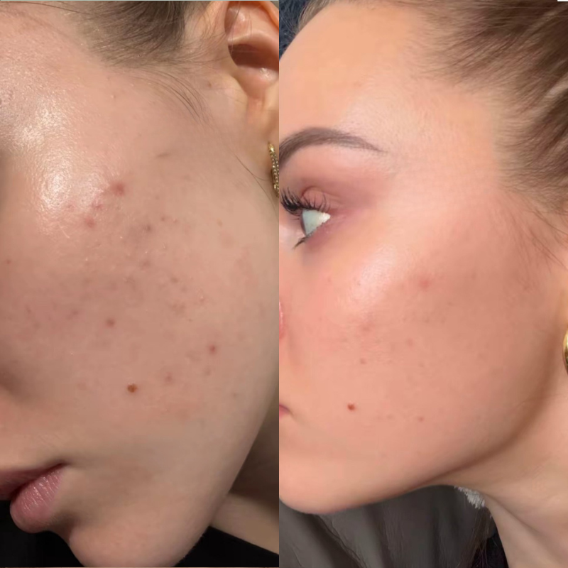 Skin Clarity