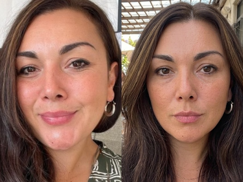 Smoother Skin & Refined Texture
